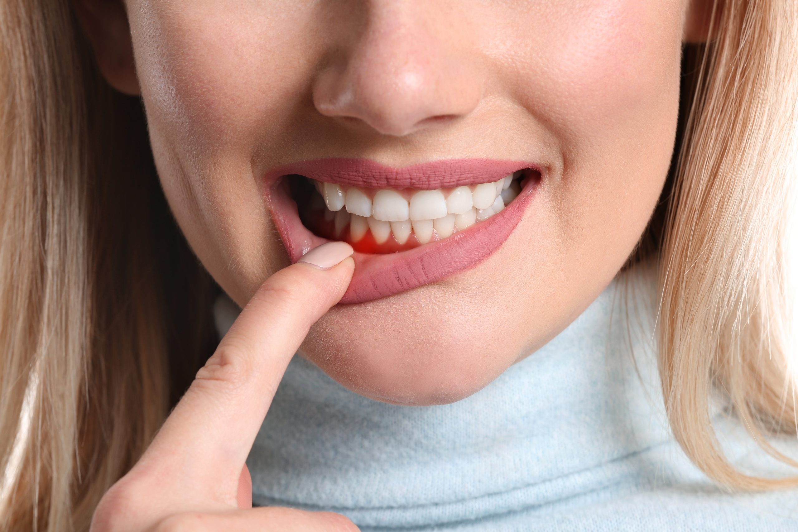 The 4 Stages of Gum Disease